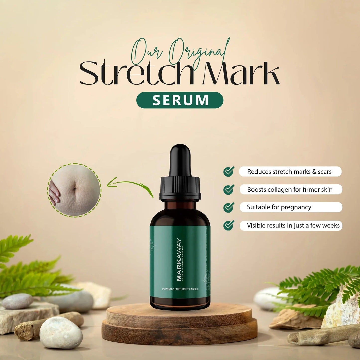 Mark Away – Stretch Mark Remover Serum